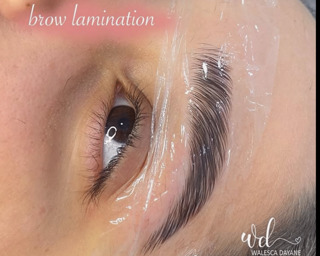 O Brow Lamination é uma técnica estética que alinha e organiza os fios das sobrancelhas, deixando-os mais definidos, simétricos e com aparência de mais volume. O procedimento consiste na aplicação de produtos específicos que moldam os fios, permitindo que fiquem penteados para cima ou na direção desejada, criando um efeito de sobrancelhas mais cheias, alinhadas e sofisticadas. Diferente da micropigmentação, o Brow Lamination não envolve pigmento na pele — ele atua apenas nos fios naturais. É perfeito para quem tem fios rebeldes, desalinhados ou deseja aquele efeito de sobrancelha natural, porém mais marcada e bem cuidada. O resultado dura, em média, de 4 a 6 semanas, sendo uma ótima opção para quem quer praticidade no dia a dia, sem precisar corrigir ou maquiar as sobrancelhas constantemente.
